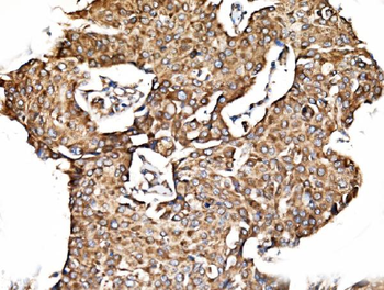 TIMM29 Rabbit Polyclonal Antibody