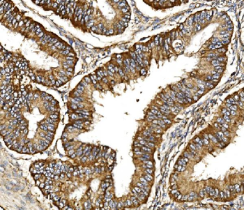 TIMM29 Rabbit Polyclonal Antibody