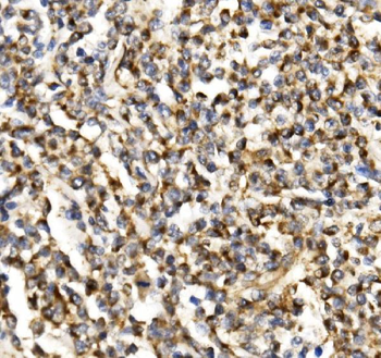 TIMM29 Rabbit Polyclonal Antibody