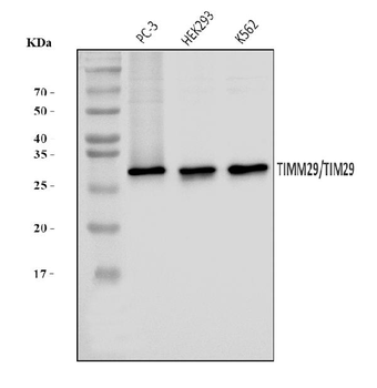 TIMM29 Rabbit Polyclonal Antibody