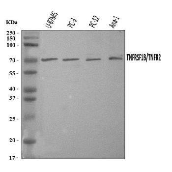 TNF Receptor II/TNFRSF1B Rabbit Polyclonal Antibody
