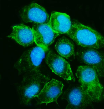 YARS1 Rabbit Polyclonal Antibody