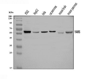 YARS1 Rabbit Polyclonal Antibody