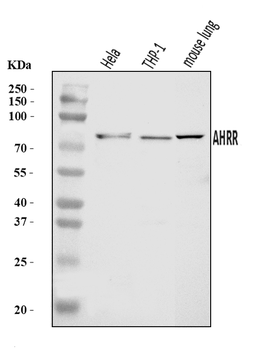 AHRR Rabbit Polyclonal Antibody
