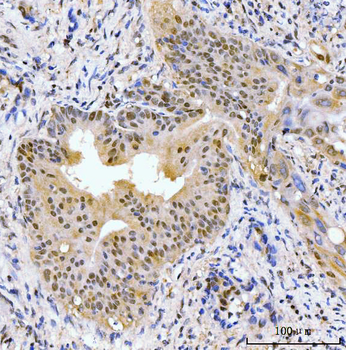 AKAP 95/AKAP8 Antibody