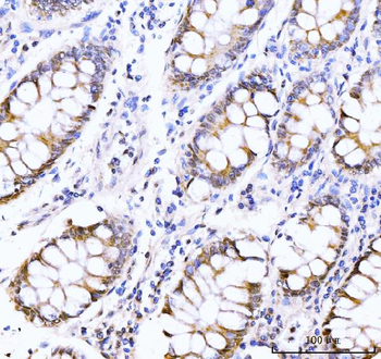AKAP 95/AKAP8 Antibody