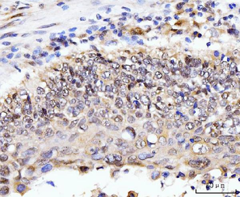 AKAP 95/AKAP8 Antibody