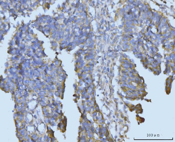 BCKDK Rabbit Polyclonal Antibody