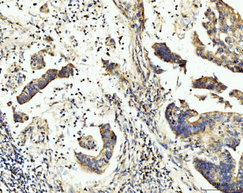 BCKDK Rabbit Polyclonal Antibody
