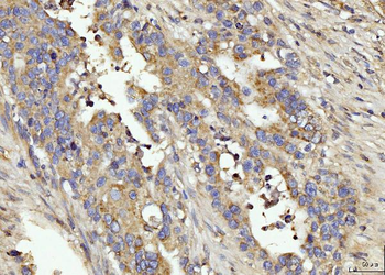 BIN1 Rabbit Polyclonal Antibody
