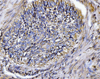 BIN1 Rabbit Polyclonal Antibody