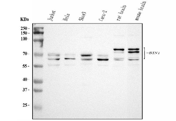 BIN1 Rabbit Polyclonal Antibody