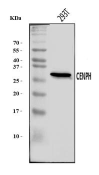 CENPH Rabbit Polyclonal Antibody