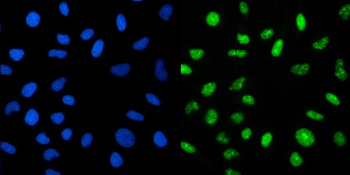 CRTC3 Antibody