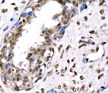CRTC3 Antibody