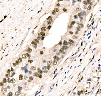 CRTC3 Antibody