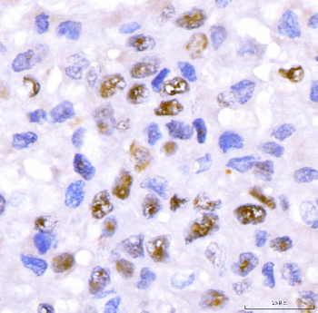 CRTC3 Antibody