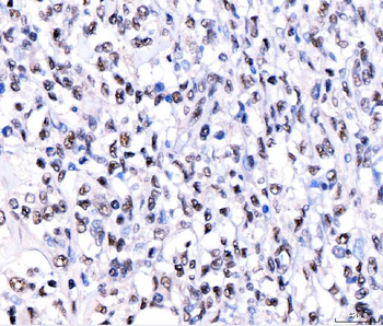 CRTC3 Antibody