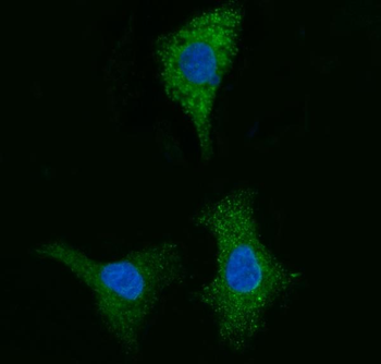 CYB5B Antibody