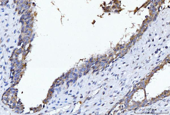 CYB5B Antibody