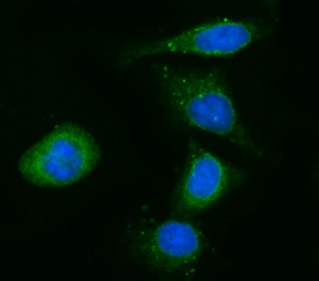 CYB5R3 Rabbit Polyclonal Antibody