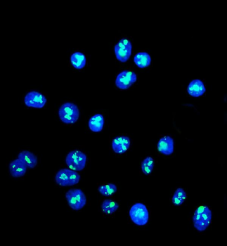 DDX21 Rabbit Polyclonal Antibody