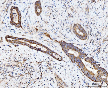 ECSIT Antibody