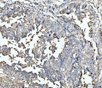 ECSIT Antibody