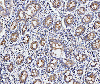 ECSIT Antibody