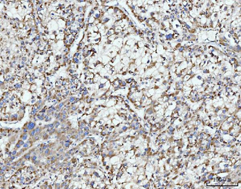 ECSIT Antibody