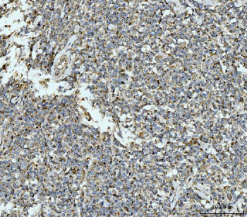 ECSIT Antibody