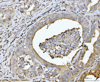 EDEM3 Rabbit Polyclonal Antibody