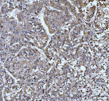 EDEM3 Rabbit Polyclonal Antibody