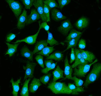 EIF5A Rabbit Polyclonal Antibody