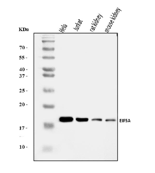 EIF5A Rabbit Polyclonal Antibody