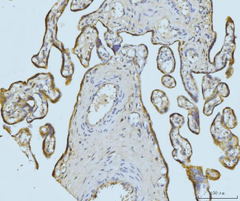 ETFA Rabbit Polyclonal Antibody