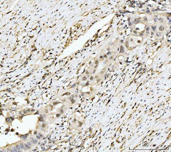 EXOSC8 Antibody