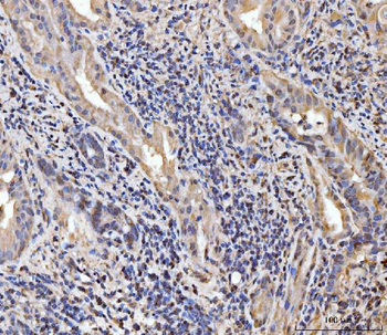 EXOSC8 Antibody