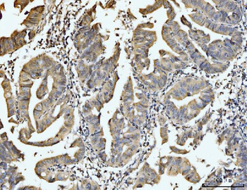 EXOSC8 Antibody