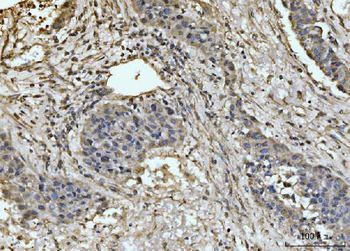 EXOSC8 Antibody