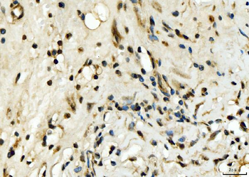 EXOSC8 Antibody