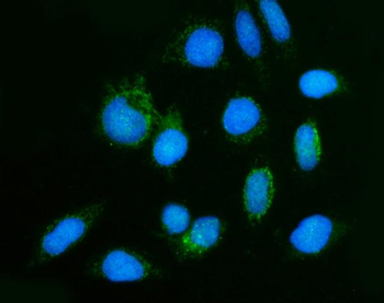 GHITM Antibody