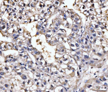 GHITM Antibody
