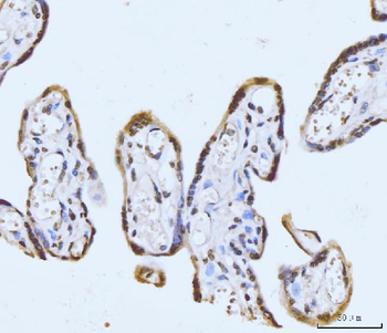 GHITM Antibody