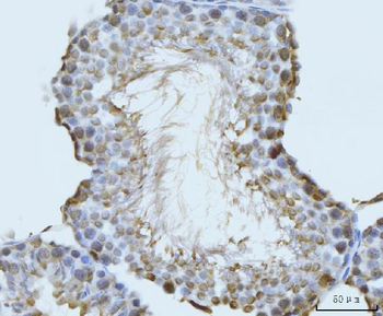 GHITM Antibody