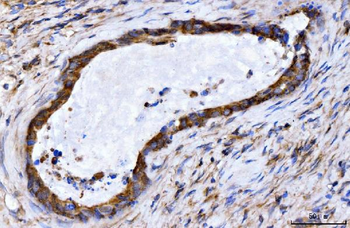 GIGYF2 Rabbit Polyclonal Antibody