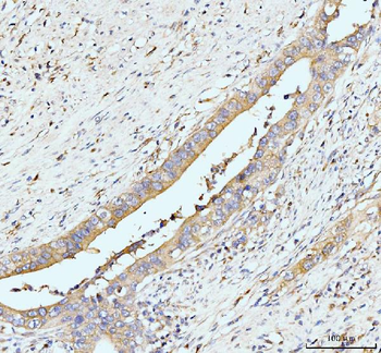 GIT1 Antibody