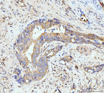 GIT1 Antibody
