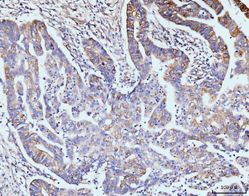 GIT1 Antibody