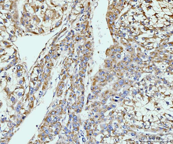 GIT1 Antibody